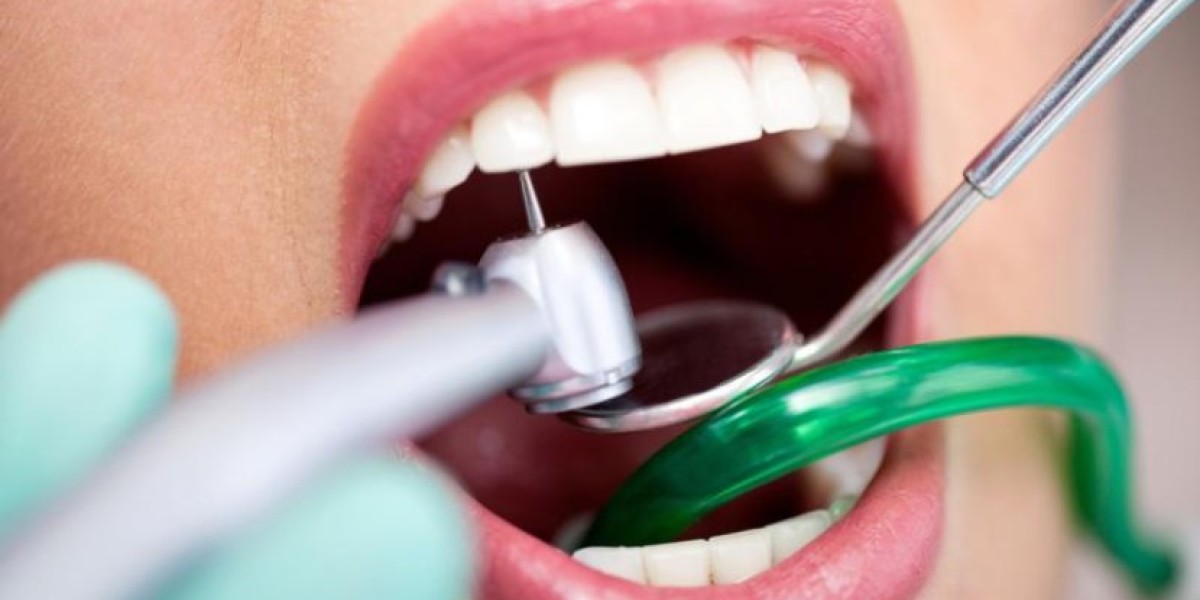 Global Dental Consumables Market | Share | Trends | Key Players | Outlook | Forecast | 2024 - 2032